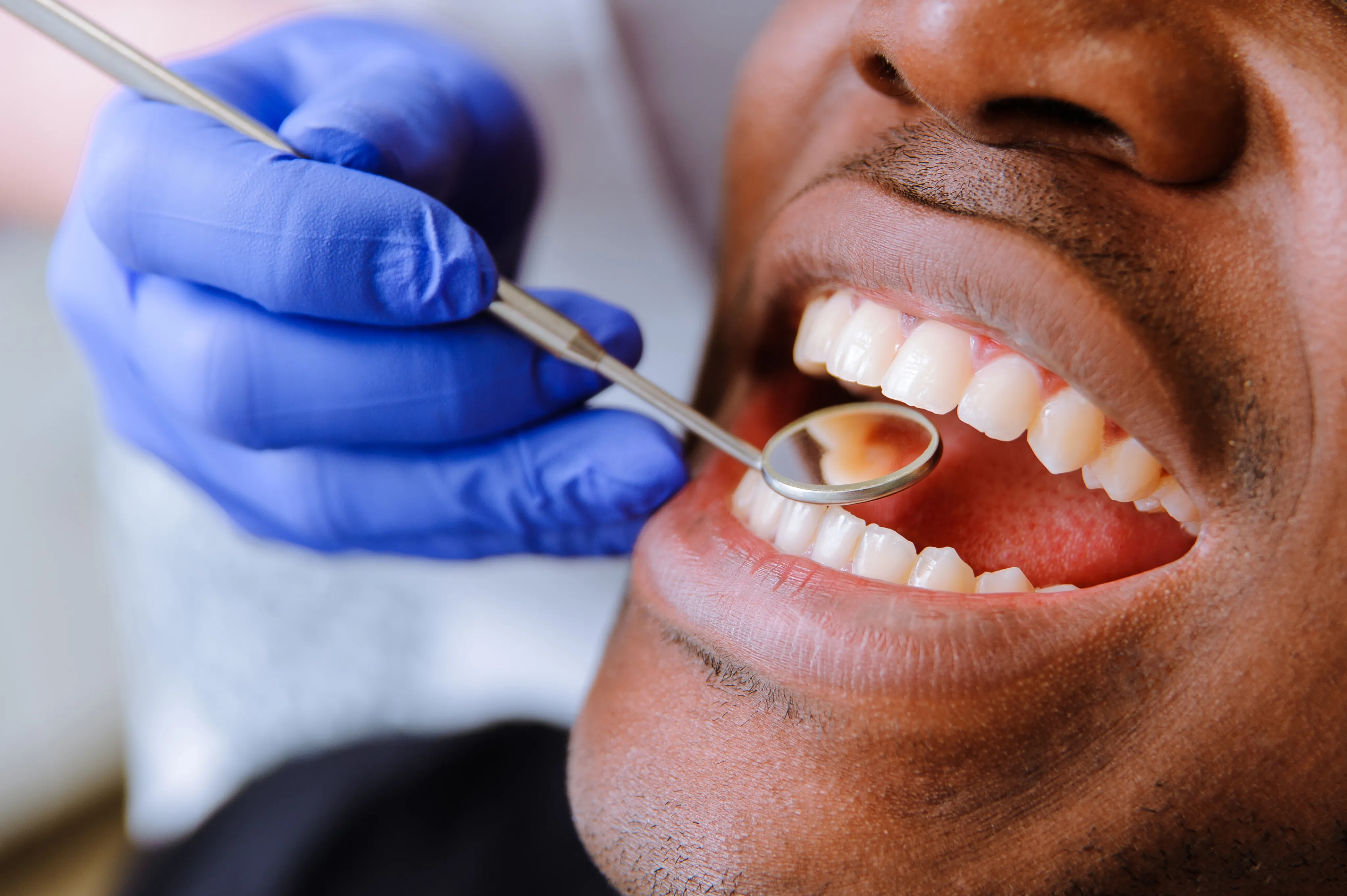 Dental veneers at Henderson and Goslee Family Dentistry